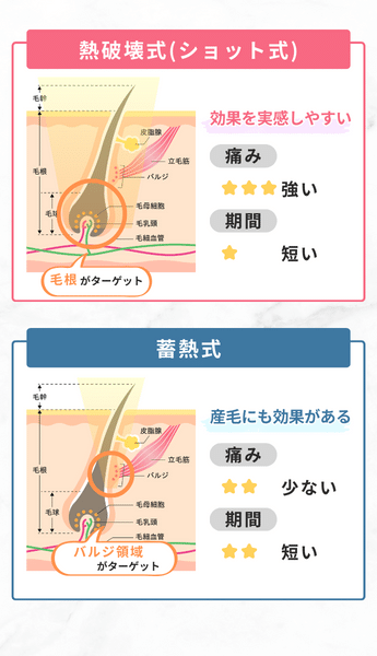 脱毛機は大きくわけて「熱破壊式」「蓄熱式」の2つ