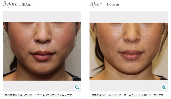 聖心美容クリニック 症例3
