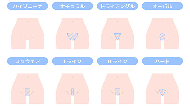 Vラインの形・デザイン