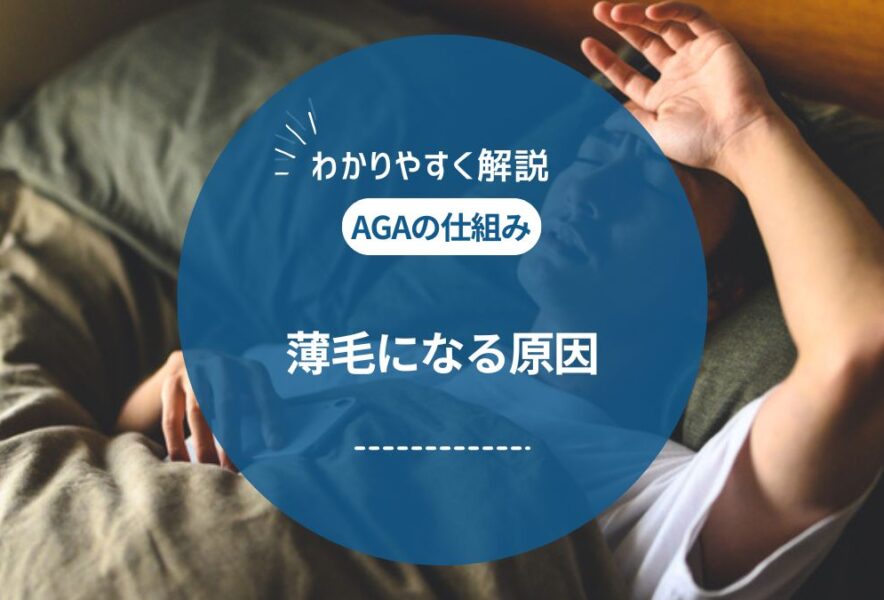 AGAの原因とセルフチェック項目！治療アプローチ・対策を解説
