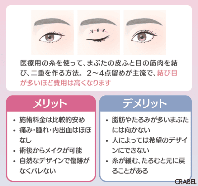 埋没法とは