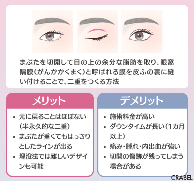 切開法とは